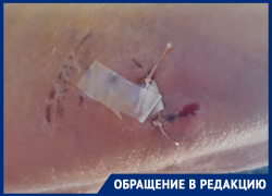 «Швы наложили в трех местах»: в Астраханской области собаки продолжают нападать на людей «Швы наложили в трех местах»: в Астраханской области собаки продолжают нападать на людей